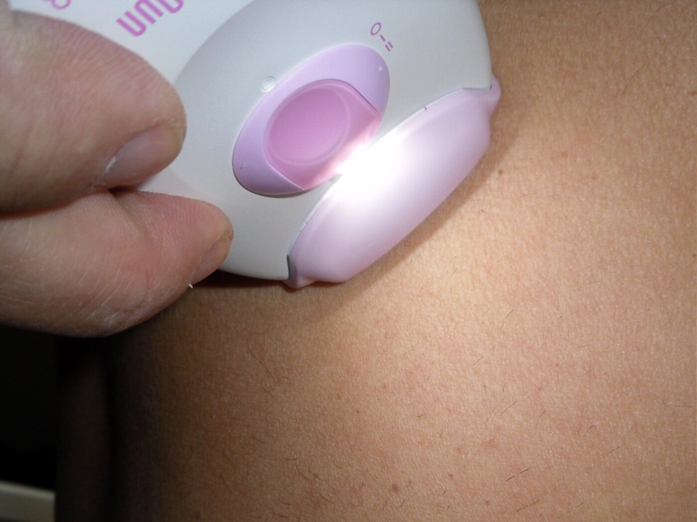 A hand holding a light-up hair-removal device against a forearm.
