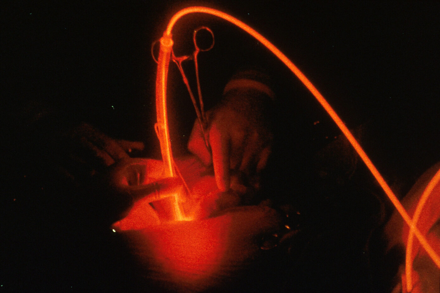 Red light in photodynamic therapy, a clinical treatment with a far stronger evidence base than home masks.