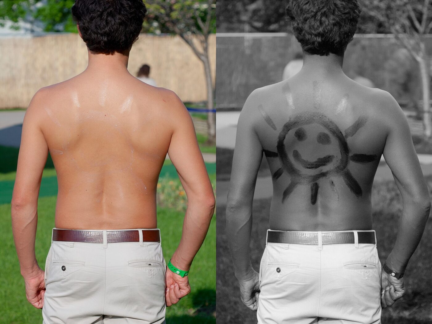 The same back in normal and UV light. Under UV, sunscreen shows up dark (here drawn as a smiley face), so coverage you can't see becomes obvious.