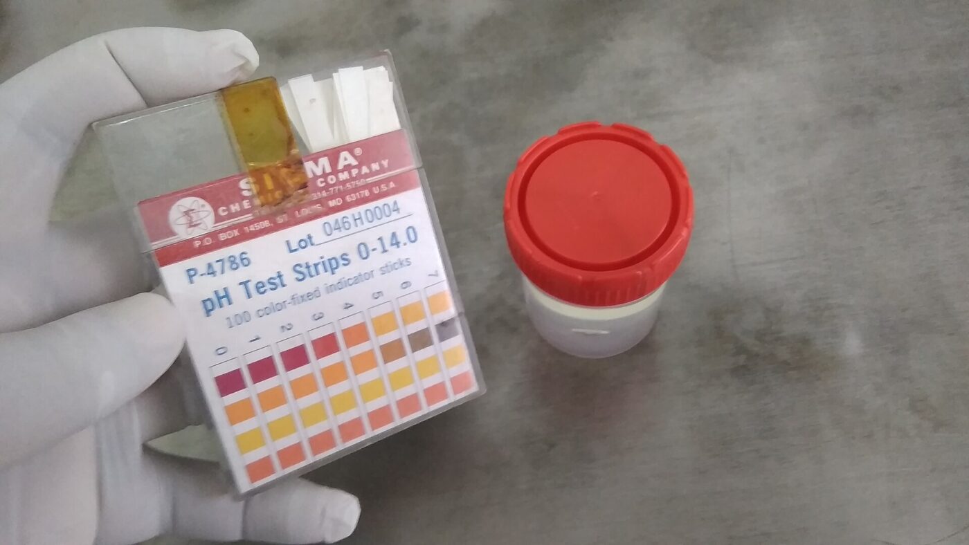 Box of pH test strips with a color chart, held next to a sample cup.